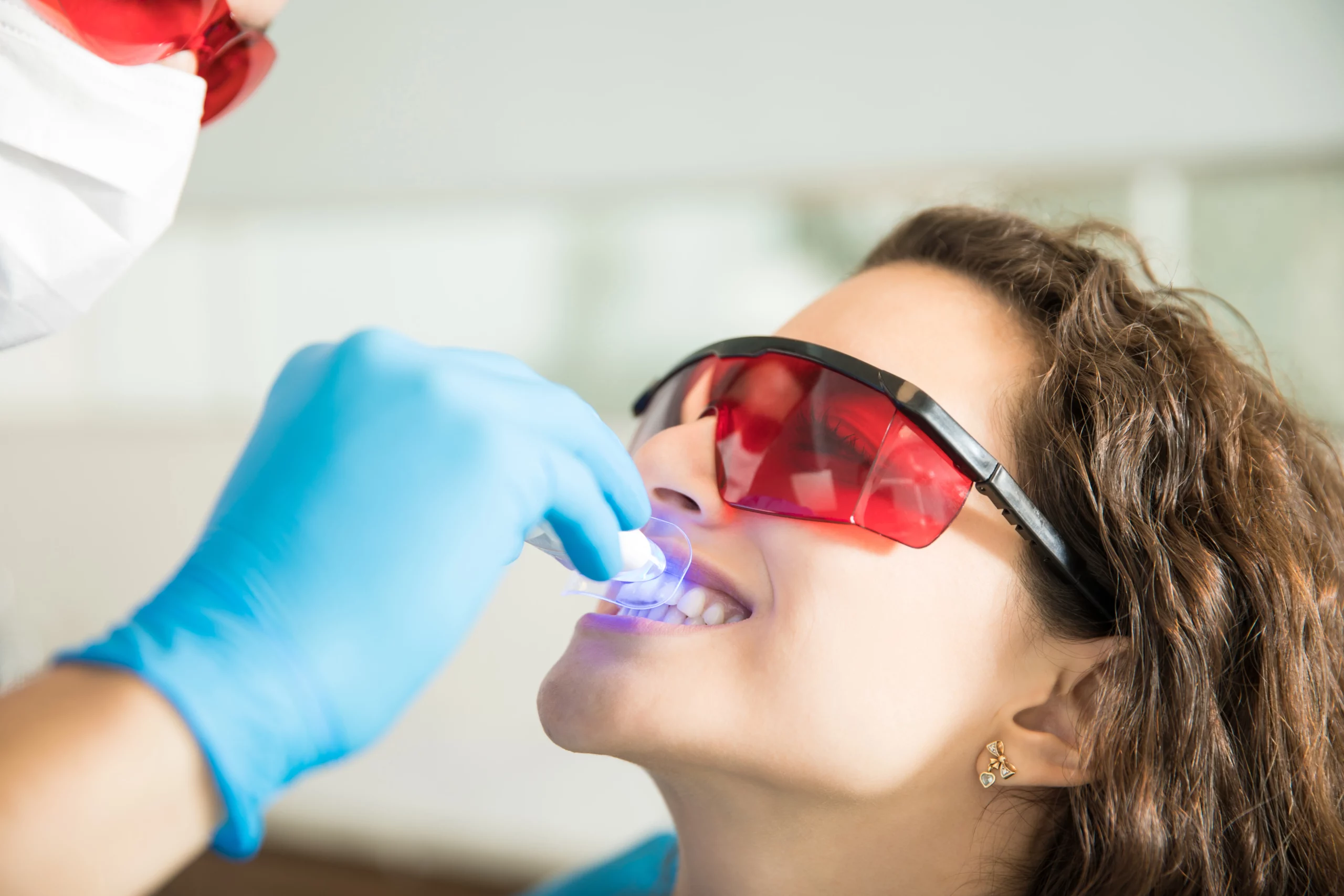in office teeth whitening