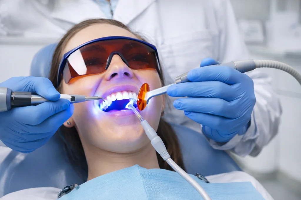laser teeth whitening london treatment process