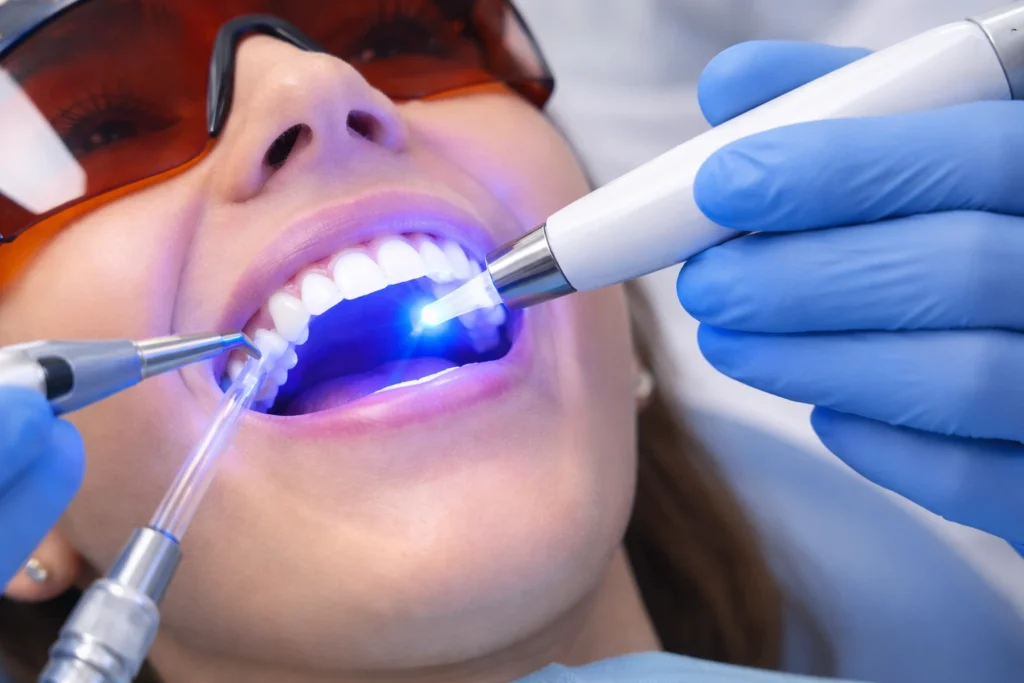 teeth staining vs whitening before and after lifestyle effects